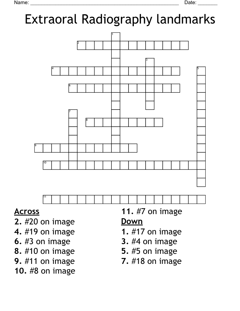 Extraoral Radiography landmarks Crossword